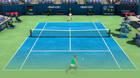 Tennis Elbow 4