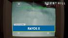 Puzle de los rayos X en Silent Hill Townfall y solución