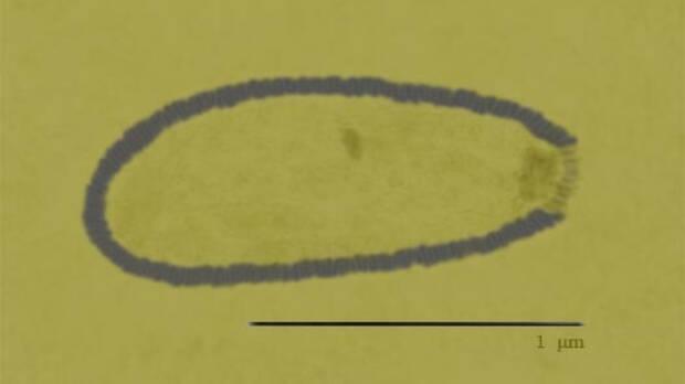 Virus gigante del �rtico