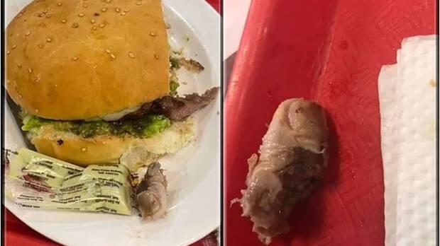 Dedo cortado en hamburguesa