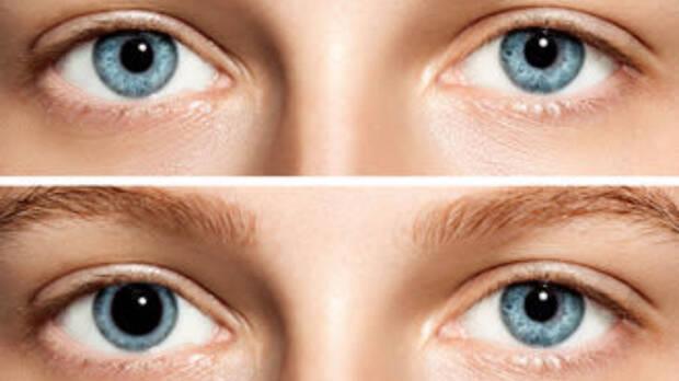 Ojos dilatados y contraídos