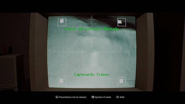 Silent Hill Townfall - Zoe: El paciente; cr�neo del paciente cuadrado