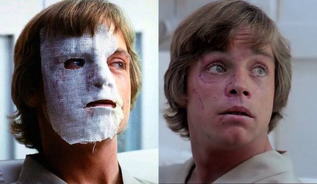 Heridas de Mark Hamill tras el accidente de coche de 1977