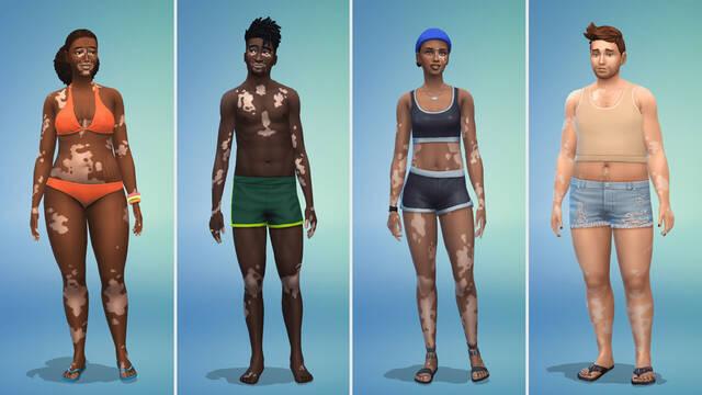 Los Sims 4 introduce la piel de vit�ligo en su nueva actualizaci�n gratuita.