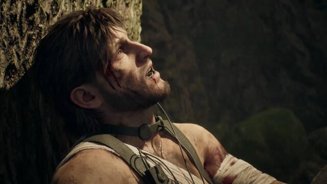 Metal Gear Solid Delta: Snake Eater tendr� un sistema de heridas permanentes
