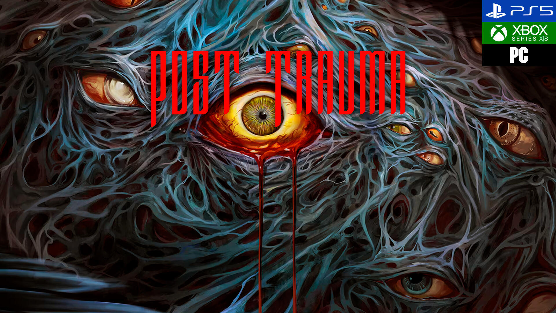 Post Trauma